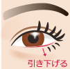 下眼瞼下制術 切開法(たれ目術・グラマラスライン形成)イメージ