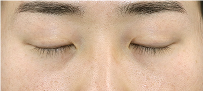 After image