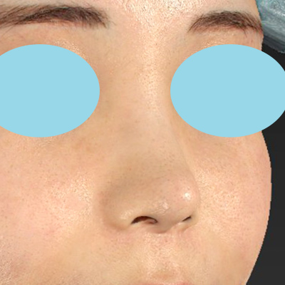 After image