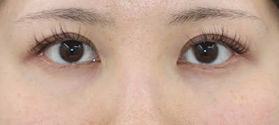 After image