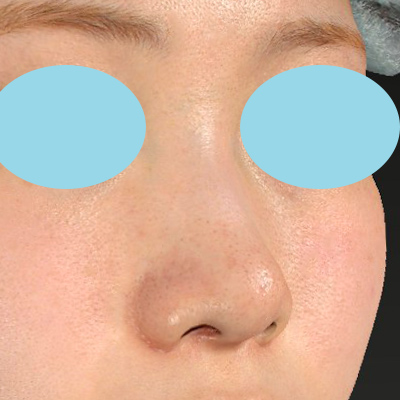 After image