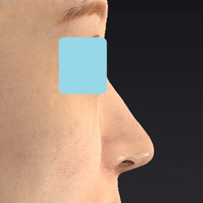 After image
