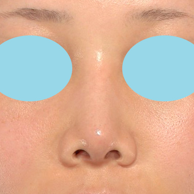 After image