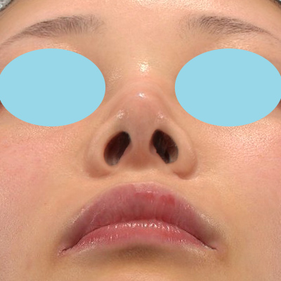After image