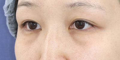 Before image