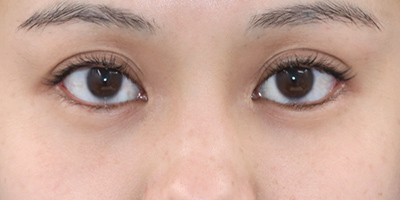 After image