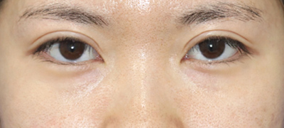 After image