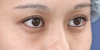 Before image