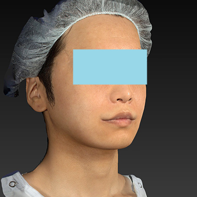 After image