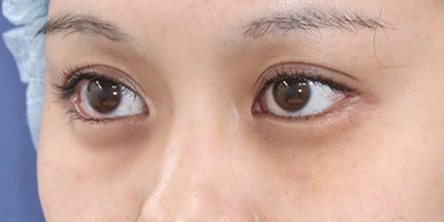 Before image
