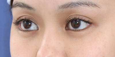 After image