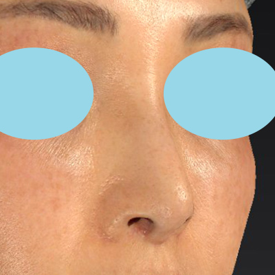 After image