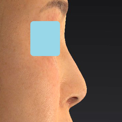 After image