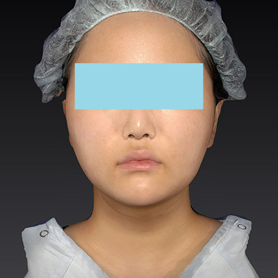 After image