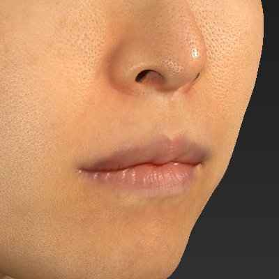 After image