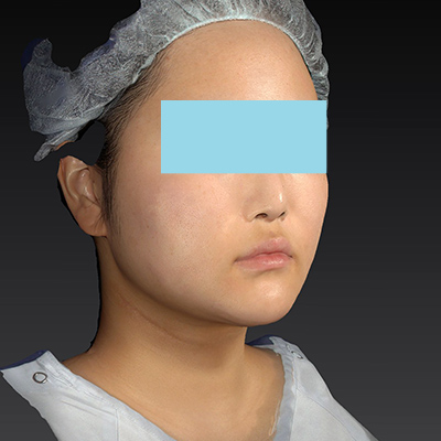 After image