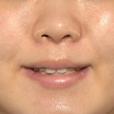 After image