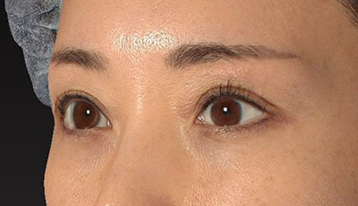 After image