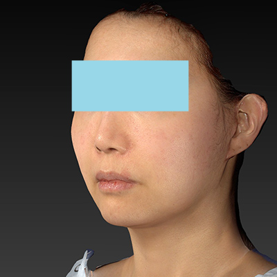 After image