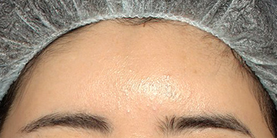 After image