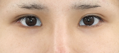 After image