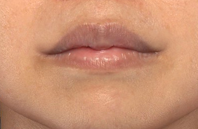 After image
