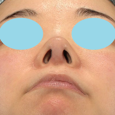 Before image