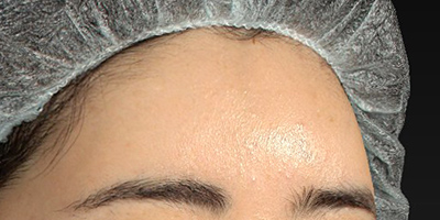After image