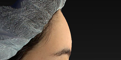 After image