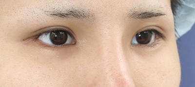 After image