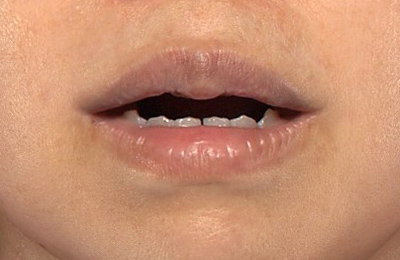 After image