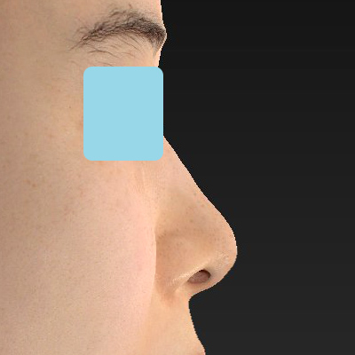 Before image