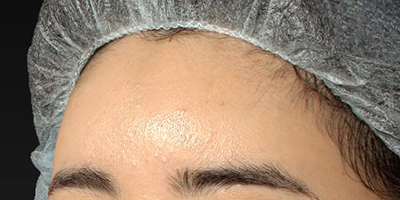 After image