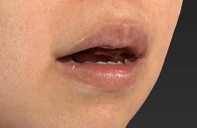 After image