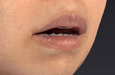 After image