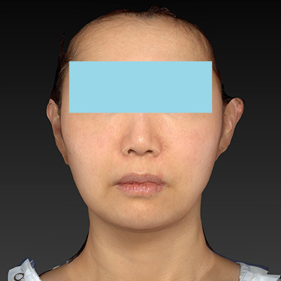 After image