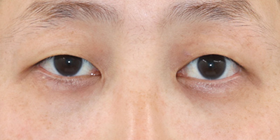 After image