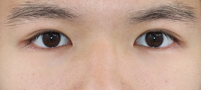After image