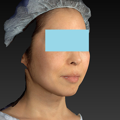 Before image
