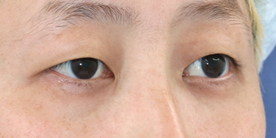 After image