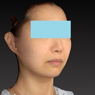 After image