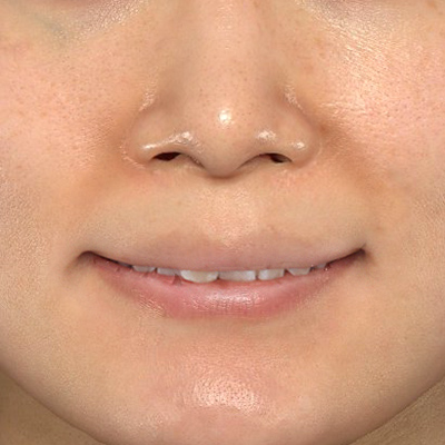 Before image