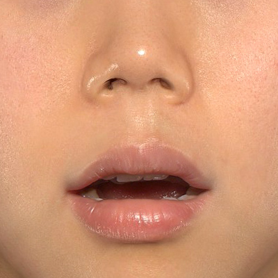 Before image