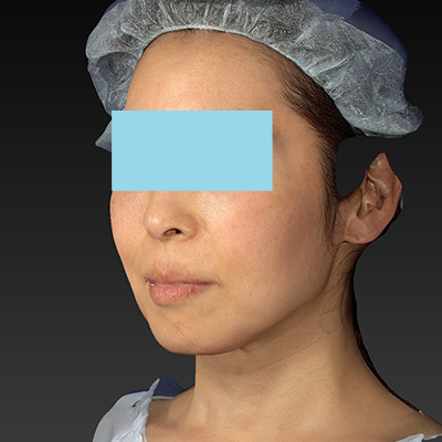 Before image