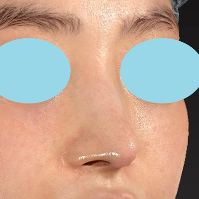 After image