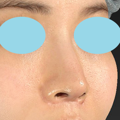 After image