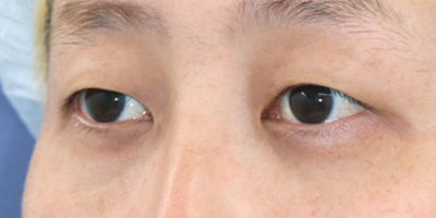 After image