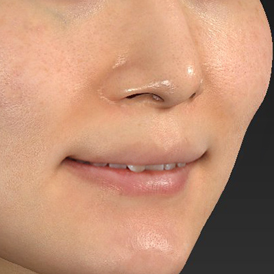 Before image