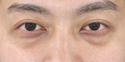 Before image