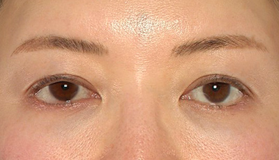 Before image